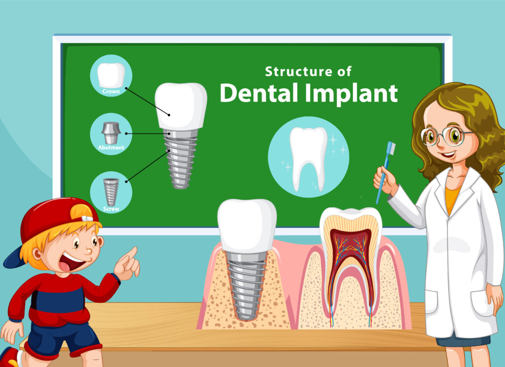 Ways to Save Money on Dental Implants