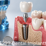 $399 Dental Implants